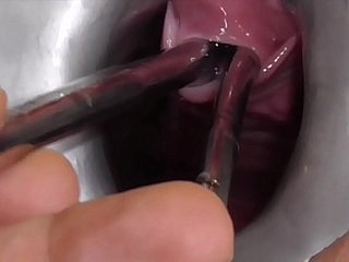 Am Nghiệp Freyjaanalslut: Nhiều âm thanh - James đang trải dài niệu đạo của Freyja với nhiều âm thanh - đi tiểu vào lồn gaping của Freyja