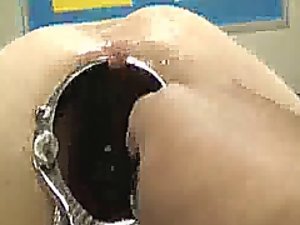 Impressive espéculo anal escancarado e o fisting